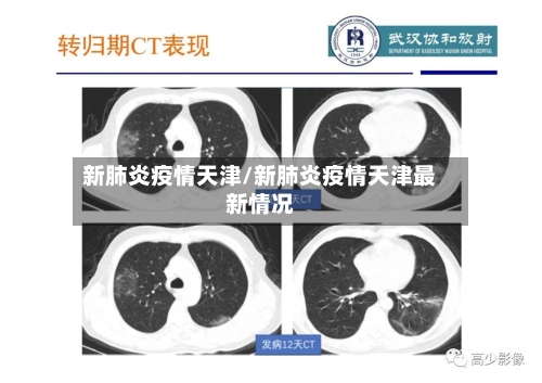 新肺炎疫情天津/新肺炎疫情天津最新情况-第2张图片